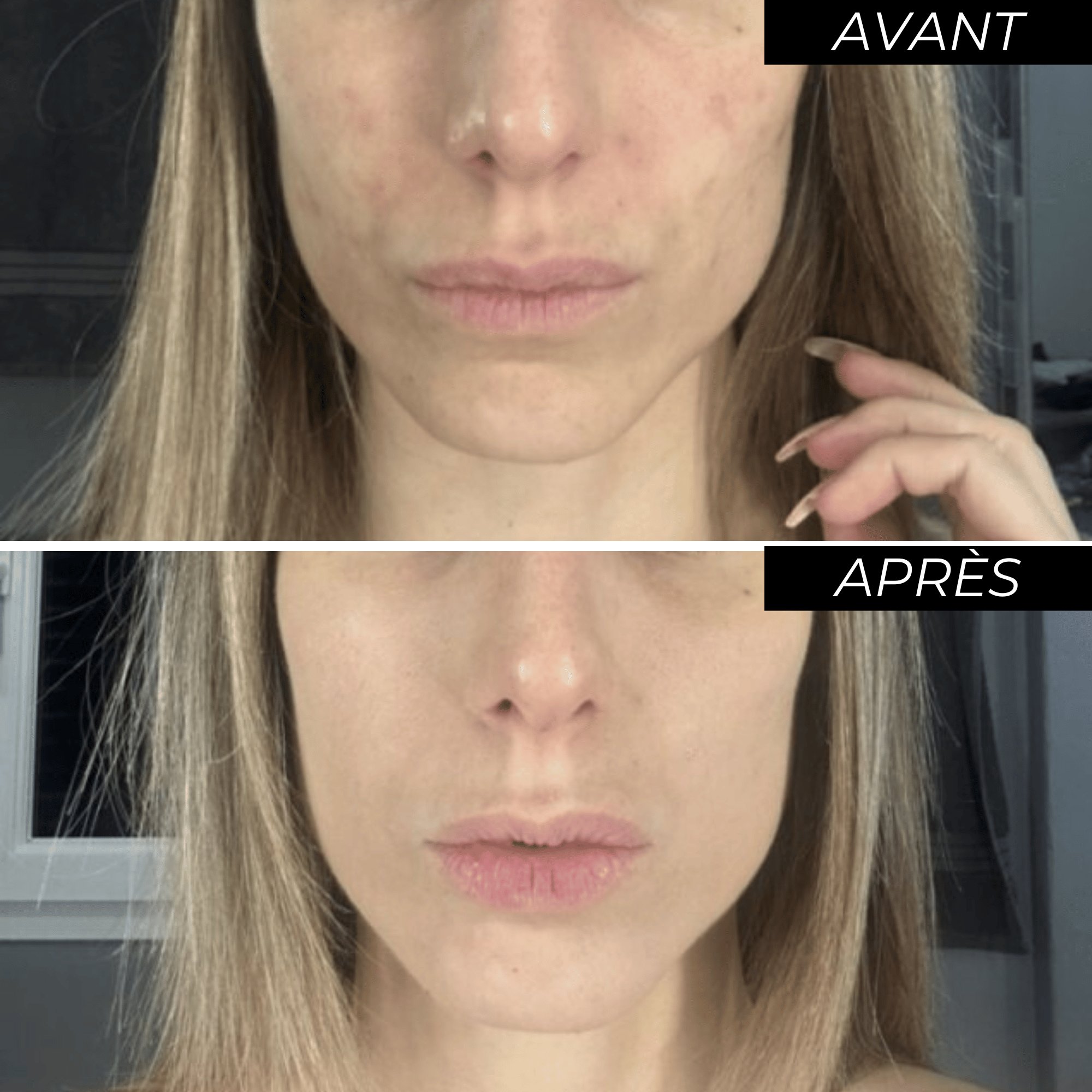 Duo Anti-taches ENOBRIGHT avant après-Image5