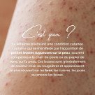 ENOLISS Perfect Skin Body 25 AHA et ENOCARE PRO Emulsion Relipidante