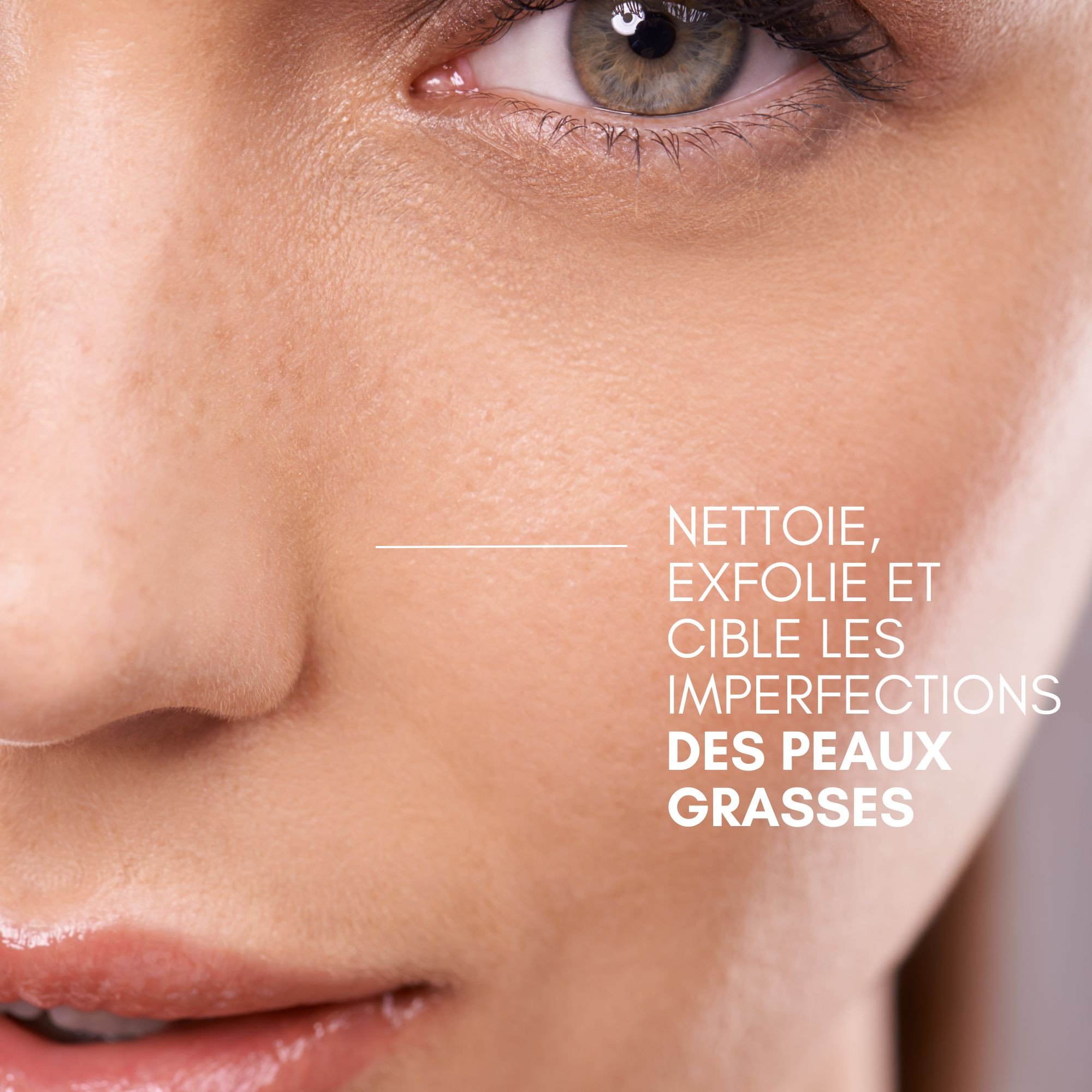 Kit no Spot Peaux grasses bénéfices-Image1