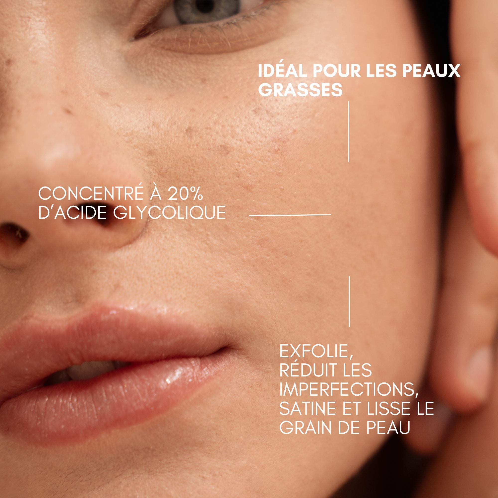 Perfect Skin 20 AHA bénéfices pour la peau-Image2