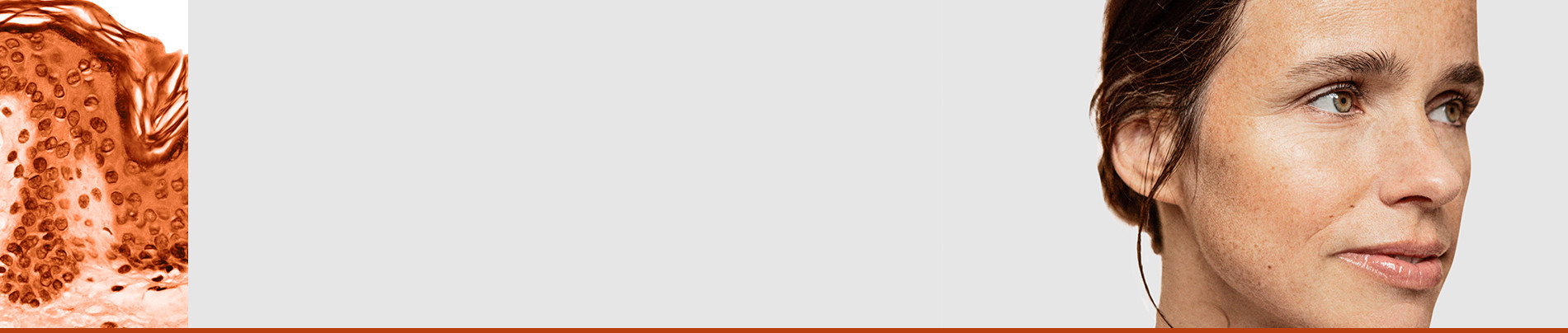 Hyperpigmentation et tâches 